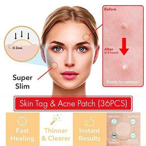 Natural Skin Tag Acne Patch (Set of 36 Pieces)