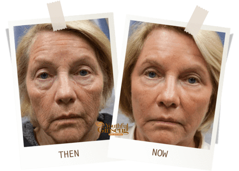 Youthful Ginseng (Look 10 Years Younger) - Buy 2 FREE 1